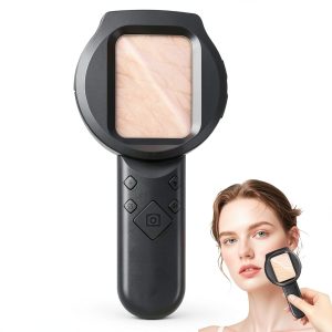 Ritzephyria 100× Dermatoscope with LED Light and 2.8" IPS Display-0