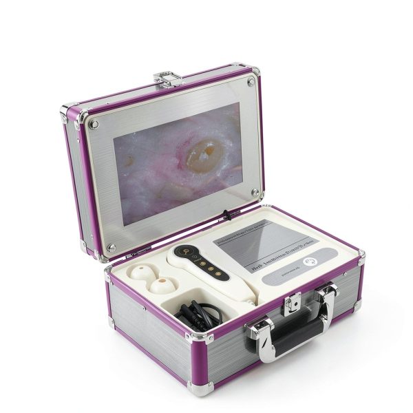 Dioche Hair Analyzer with 50X/200X Lenses Skin & Scalp Imaging Device-1
