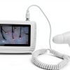Brrnoo Skin & Hair Analyzer Microscope Professional 200X Lens Portable-4
