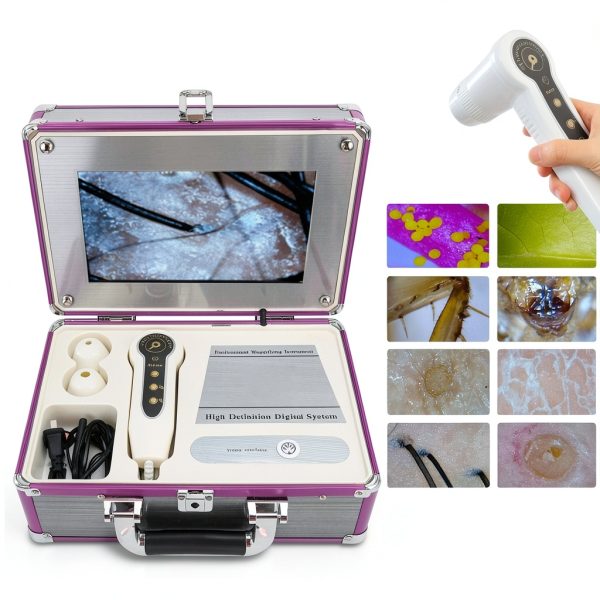 Dioche Hair Analyzer with 50X/200X Lenses Skin & Scalp Imaging Device-2