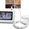 Brrnoo Skin & Hair Analyzer Microscope Professional 200X Lens Portable-1