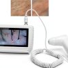 Asixxsix Skin Microscope with Dual Lens 50X/200X Portable Analyzer-2