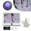 Dioche Skin Analyzer Clinical Laboratory Analyzer Model B0CCRJB9QH-3