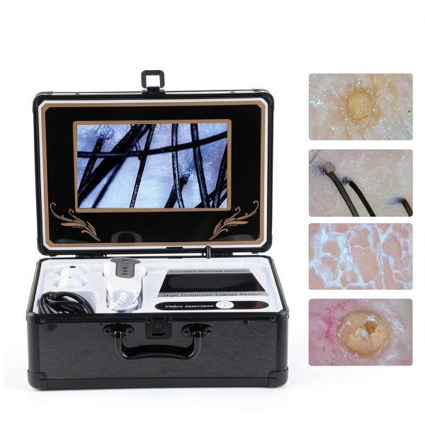 Skin Diagnosis Hair Analyzer Klanata 50X/200X Microscope Oil Detector-3