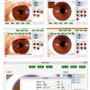Iridology Camera Analyzer QXIUDDYS 5 MP USB Iris with HD 30x Lens-5